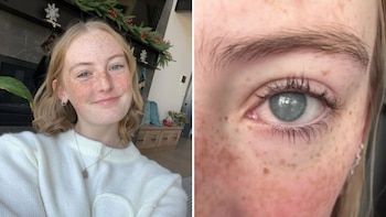 Una adolescente de 19 años pierde la vista después de ducharse con lentillas: “No valoramos lo maravilloso que es poder ver”