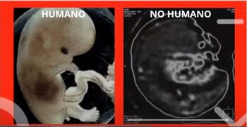 La comparación tomográfica de un