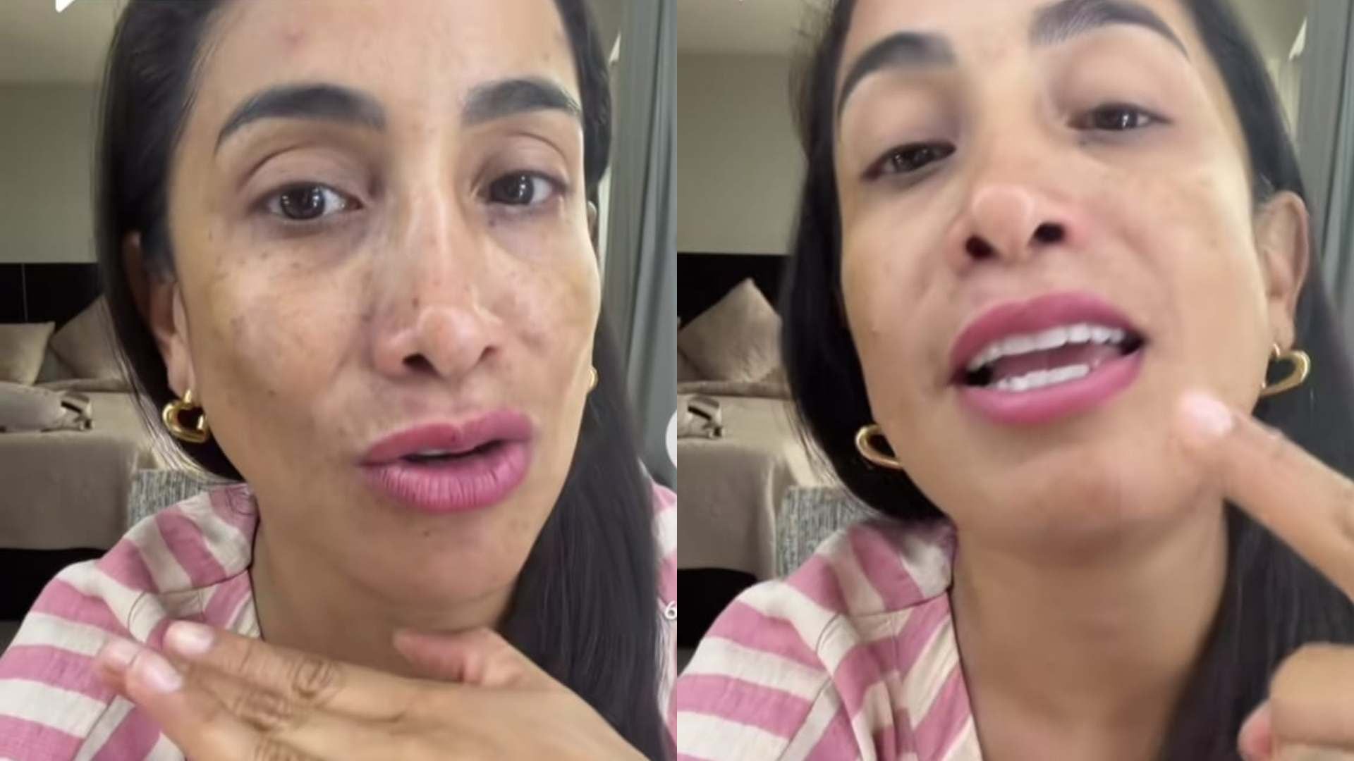 Nelly Rossinelli responde a las críticas de su piel y se muestra al natural. TikTok