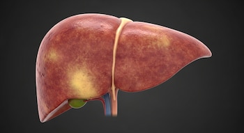 Expertos advierten que la dieta