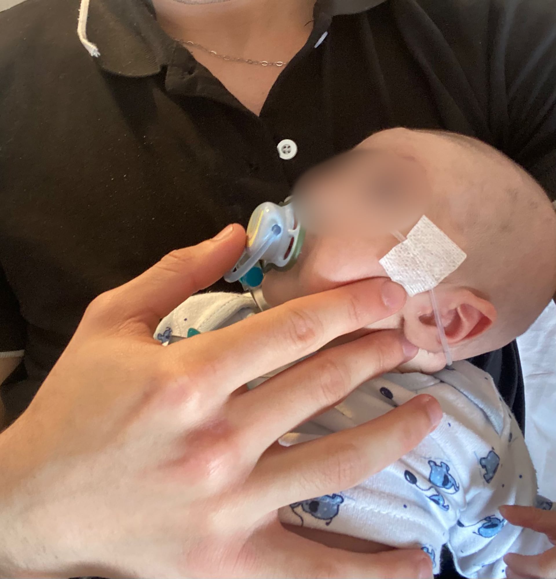 Giovanni respira con la ayuda de una cánula nasal y se alimenta a través de un botón gástrico. “Si todo sale bien, podrían darle el alta dentro una semana”, cuenta su papá