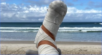 Surfista uruguayo Alejo Santiñaque fue mordido por un tiburón en Australia (Captura Subrayado/Canal 10)