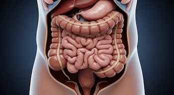 Ilustración médica 3D de un abdomen humano abierto mostrando órganos internos. Se observa un colon severamente dilatado que llena el centro de la cavidad.