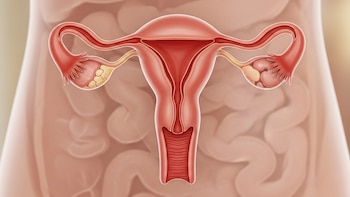 Nuevos hallazgos sobre el cáncer de ovario: descubrir el origen del tumor abre nuevas vías de prevención