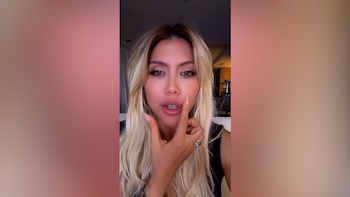 El caso de Wanda Nara expuso cómo los retoques estéticos y la imagen pública se convierten en un tema colectivo en la farándula argentina