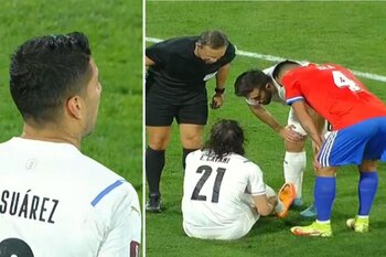 Edinson Cavani salió lesionado y