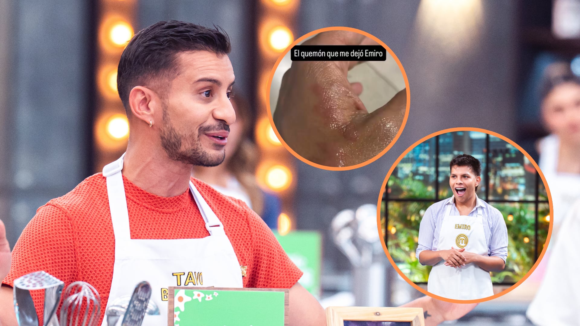 El accidente de Tavo Bernal con azúcar fundida tras un descuido de Emiro Navarro en MasterChef Celebrity - crédito cortesía Canal RCN