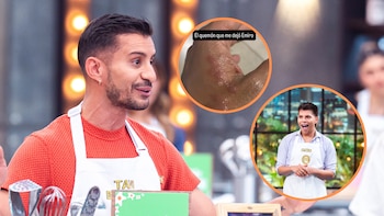Emiro Navarro le causó una grave quemadura a Tavo Bernate en ‘MasterChef Celebrity’: el comediante publicó imágenes de lo que le pasó en la mano