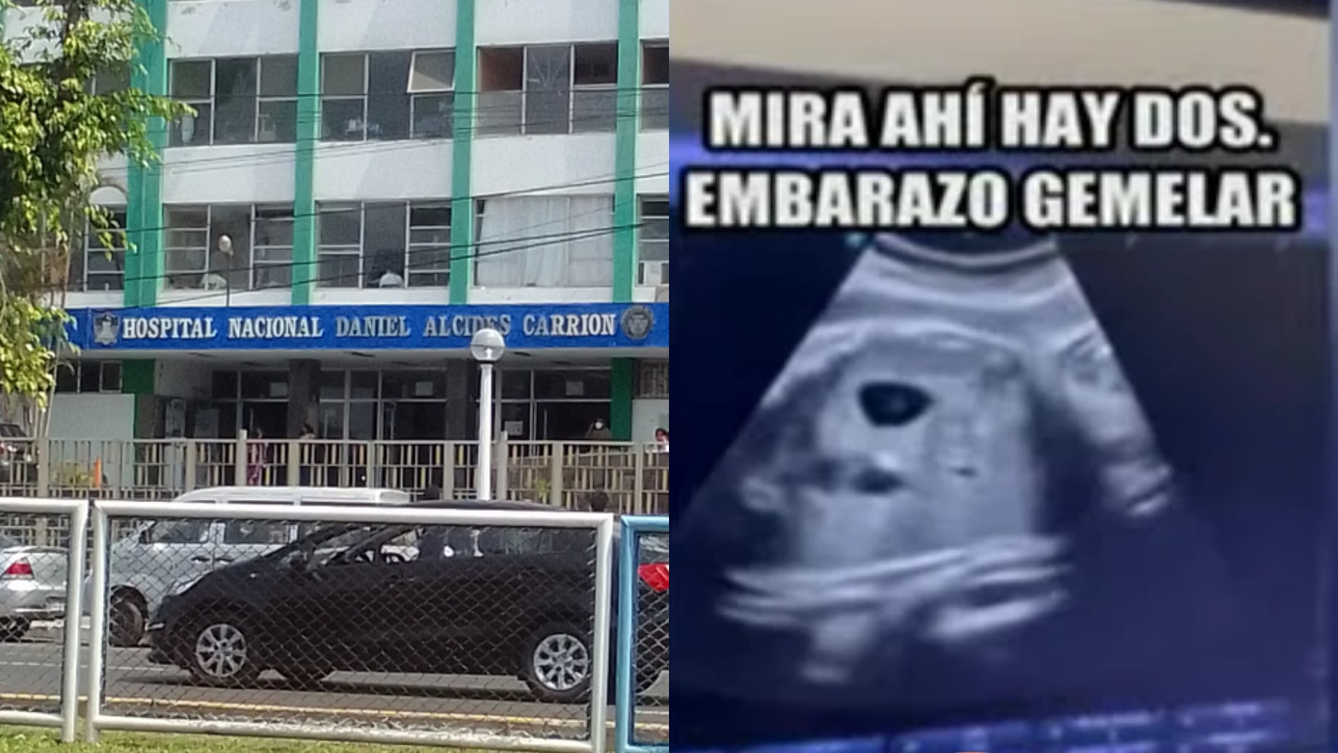 Sigue la búsqueda de la segunda gemela perdida tras parto en el Hospital Carrión del Callao: familia exige respuestas sobre su paradero