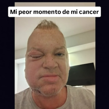 Rud enfrentó la enfermedad durante años sin diagnóstico, lo que lo obligó a cerrar su agencia de modelos en 2015 por deterioro físico