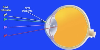 fenómeno óptico Purkinje-Sanson