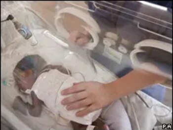 Dos bebés han fallecido en menos de 15 días tras presentar complicaciones de salud. (FOTO:BBC)