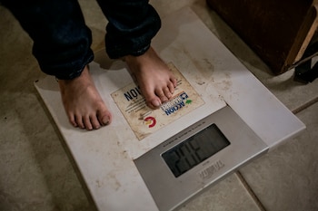 El índice de desnutrición en