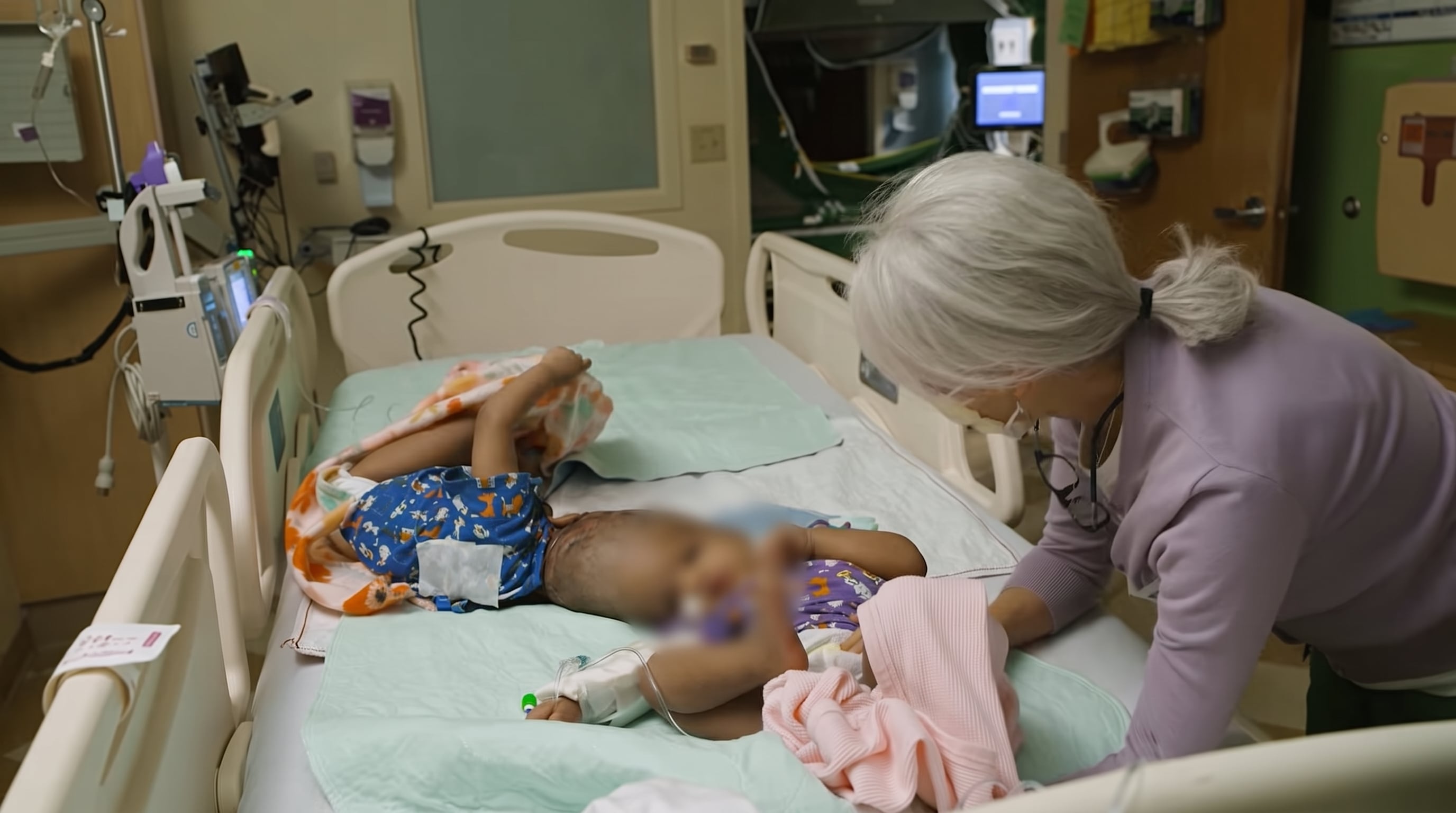 Hiyab y Wuhbto padecían craniopago, una condición en la que dos gemelos están unidos por el cráneo y cuya separación exige planificación de varias especialidades (Captura SSM Health Cardinal Glennon Children