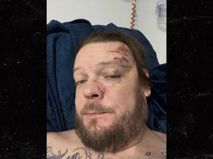 Meses antes de la emergencia médica de Rick, su hijo Corey sufrió un grave accidente de motocicleta (Créditos: History/Redes sociales)
