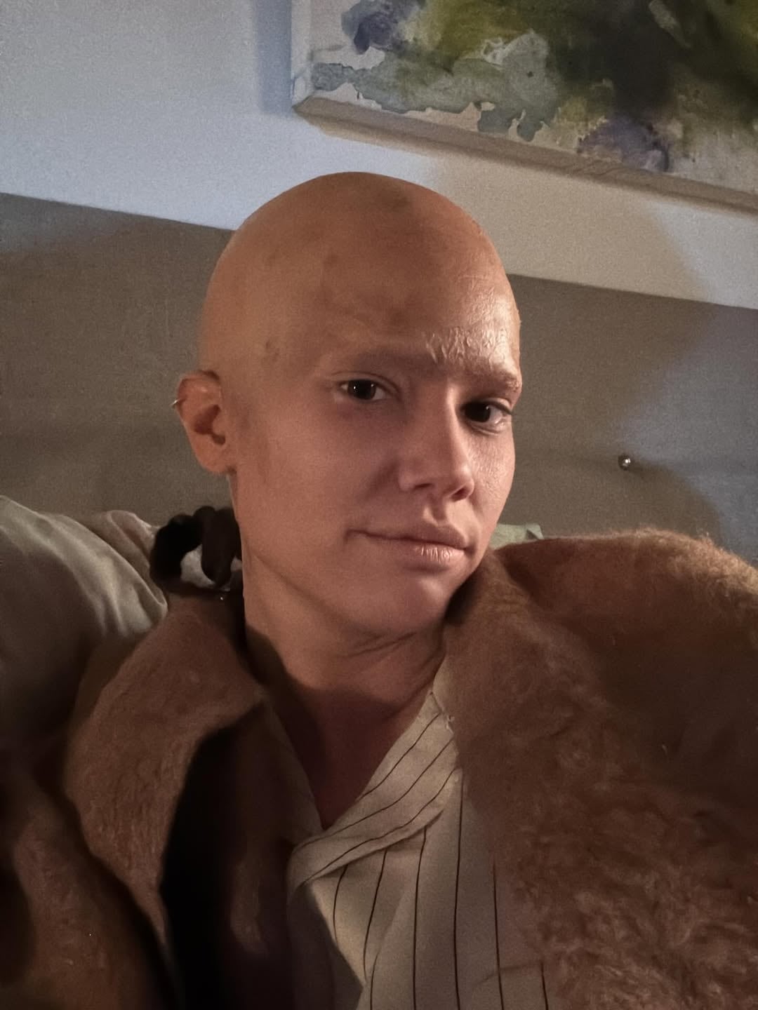 La caracterización de Manuela Viale con efecto calvo mediante maquillaje busca mostrar la transformación física y emocional de su personaje