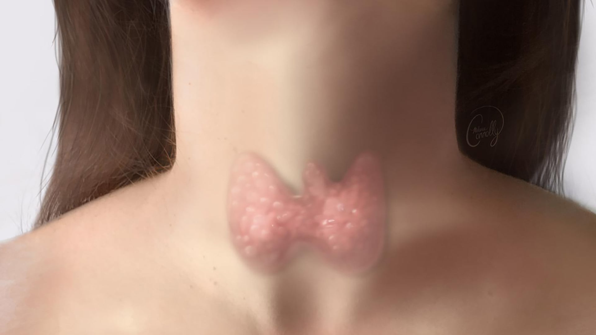 Las hormonas sexuales femeninas, especialmente los estrógenos, influyen en el funcionamiento de la glándula tiroides (Freepik)