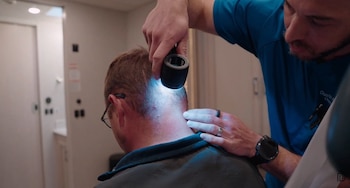 El acné queloideo nucal afecta en la autoestima de las personas. Youtube/drdustinportela