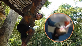 Yeferson Cossio sufrió fuerte accidente