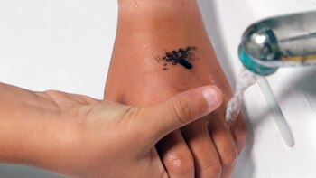 Prevención, higiene y vacunas, claves