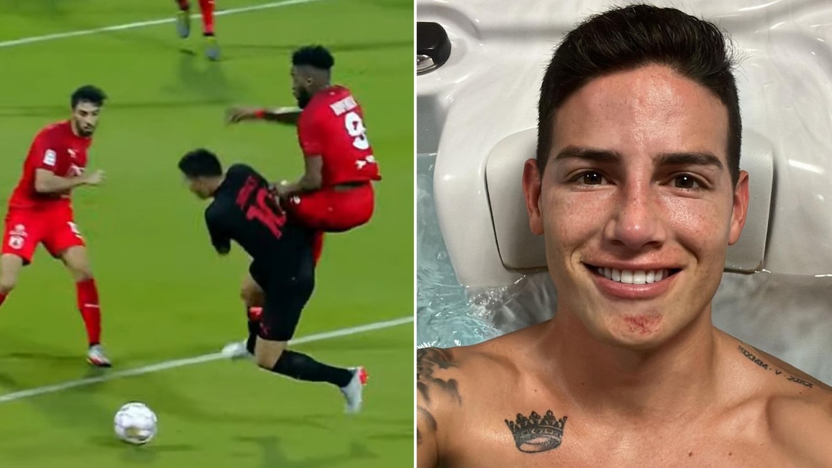 James Rodríguez envía un parte de tranquilidad tras el fuerte golpe recibido: “nada que preocuparse” - Infobae