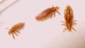 Existen dos tipos de piojos: