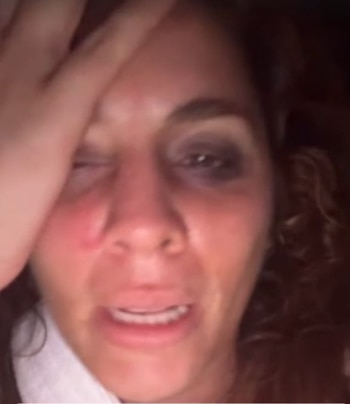 Yiddá Eslava sufre fuerte accidente