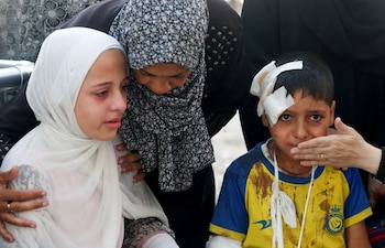 Un niño herido y otras