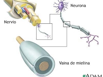 El tratamiento desarrollado en Columbia
