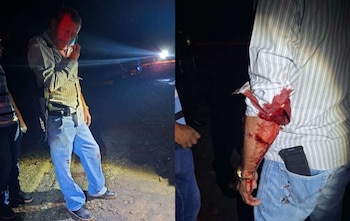 El concejal de Retalhuleu José Arturo López Moreno sobrevivió a un ataque armado en el kilómetro 202 de la carretera hacia Champerico.