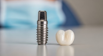 Un implante dental metálico tipo tornillo y una corona dental de cerámica en primer plano sobre una superficie gris clara y fondo difuminado.