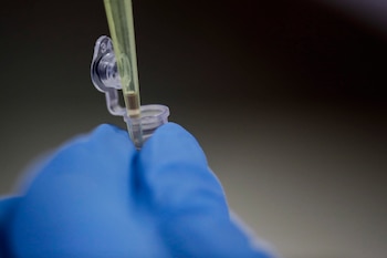 No es necesario acudir a