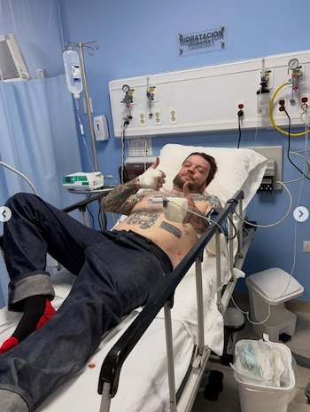 El accidente dejó a Corey