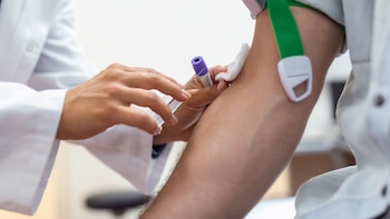 Un análisis de sangre revela los síntomas de Alzheimer años antes de que aparezca la enfermedad