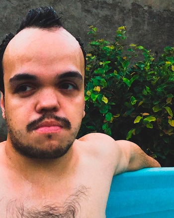 "Enano me resulta ofensivo, yo