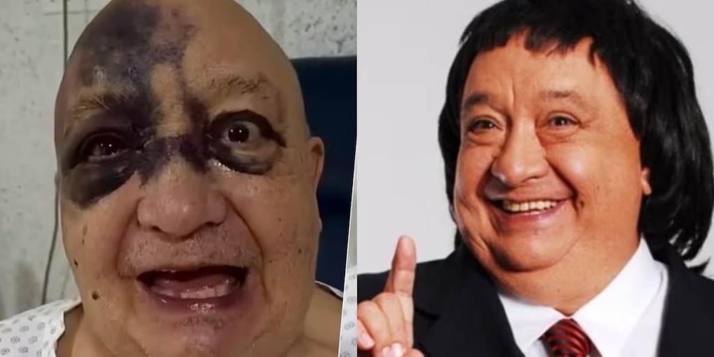 Cuál es el estado de salud del comediante Luis de Alba? 'El Pirruris' resultó lesionado tras un fuerte accidente - Infobae