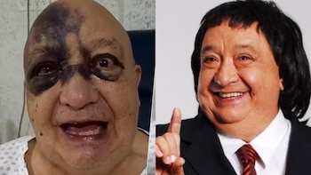 ¿Cuál es el estado de salud del comediante Luis de Alba? ‘El Pirruris’ resultó lesionado tras un fuerte accidente