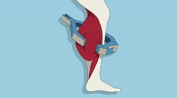 Ilustración estilizada de una pierna humana de perfil con el músculo de la pantorrilla rojo intenso y exagerado, sujetado por formas geométricas azules y grises sobre un fondo azul claro.