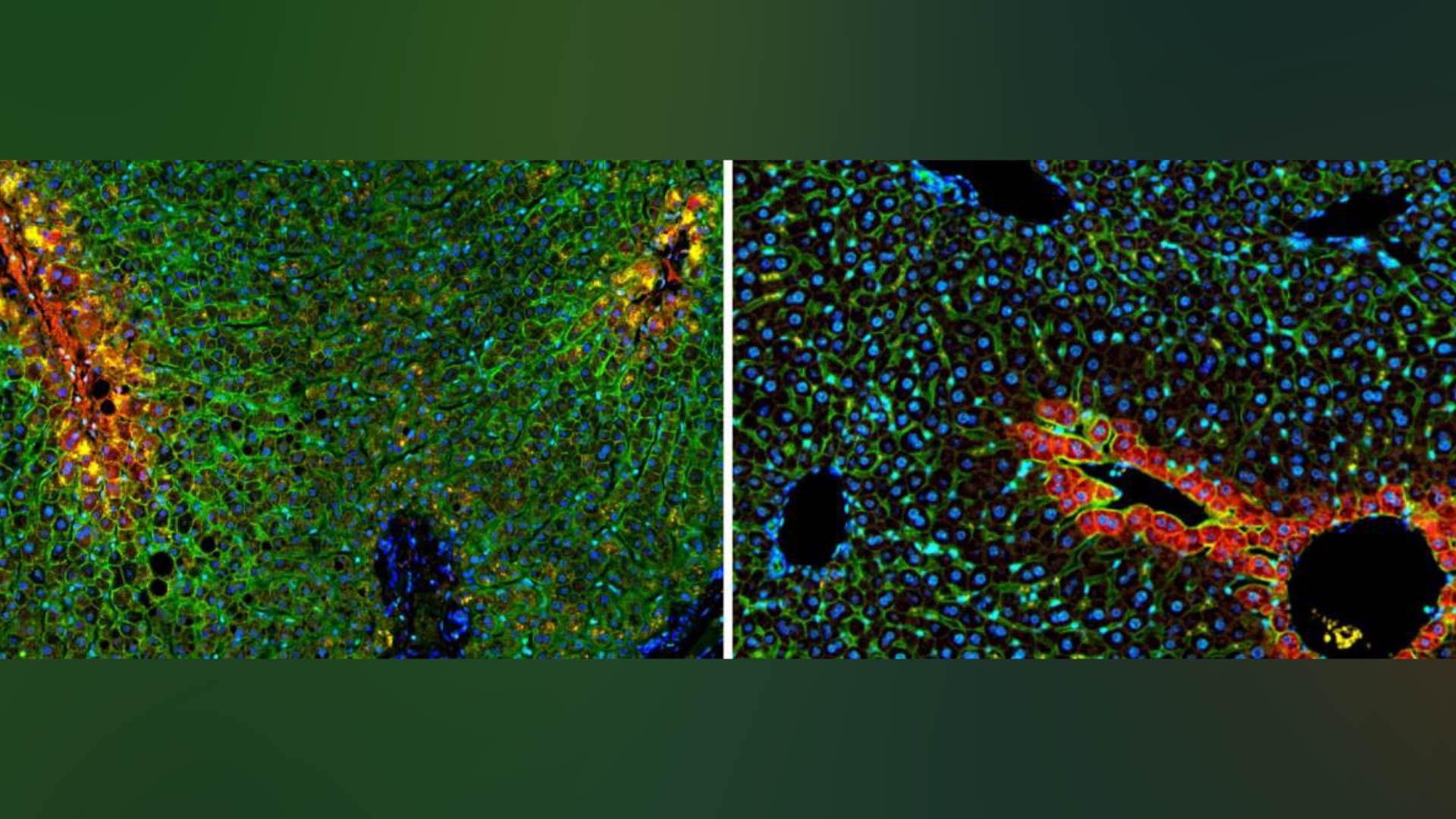La investigación logró mapear las posiciones espaciales de miles de genes activos en células hepáticas individuales con una resolución de 2 micras (Foto: Instituto Weizmann)