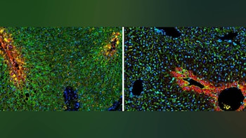 Dos imágenes microscópicas vibrantes de tejido celular, mostrando patrones intrincados en verde, azul, rojo y amarillo, con áreas oscuras de vasos