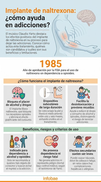 Infografía sobre el implante de naltrexona para adicciones: muestra un brazo con implante, cerebro, iconos y texto explicativo de su uso y beneficios.