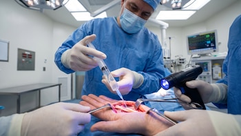 Más allá de la sutura de puntos: la biotecnología que está logrando reconectar los nervios humanos