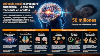 Infografía con título "Epilepsia focal", mostrando una ilustración de cerebro con descargas eléctricas, una persona durmiendo y secciones con texto e íconos.