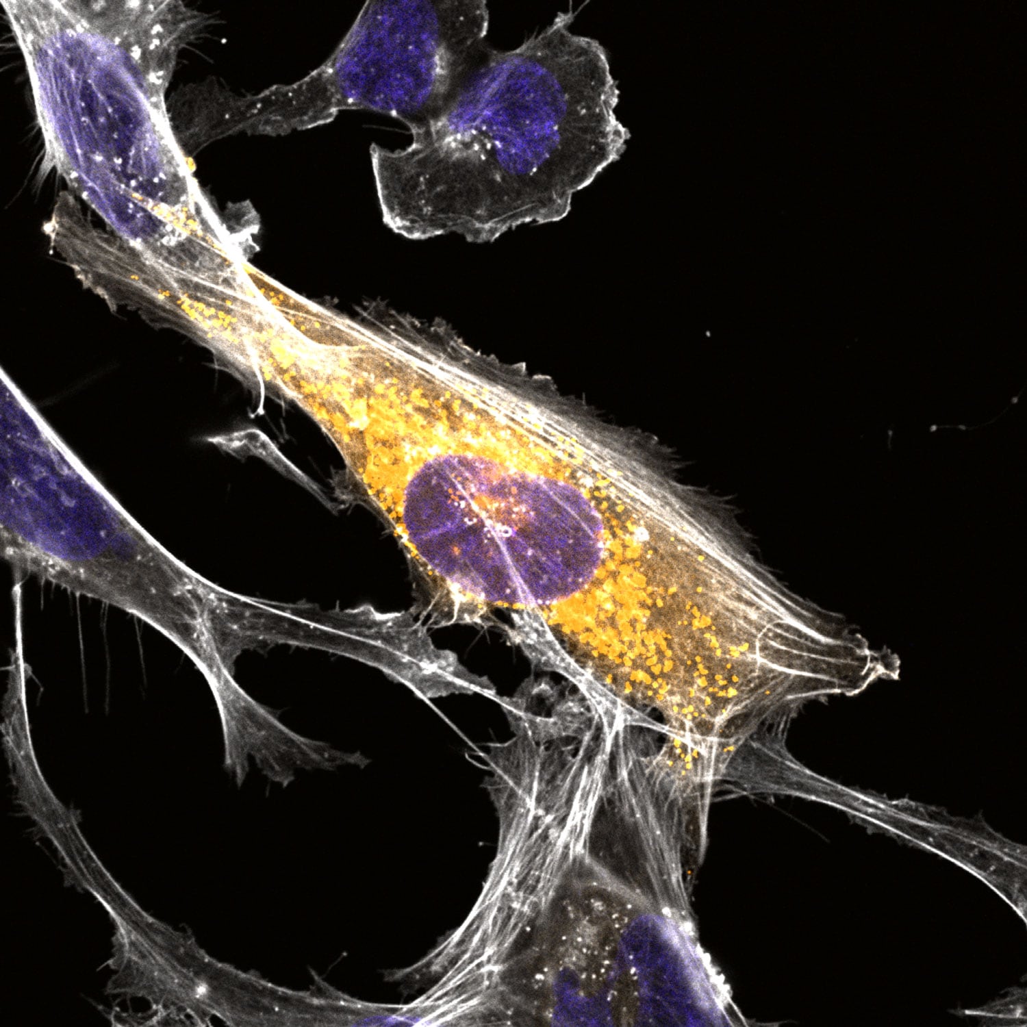 Una célula microglial en la que se acumula una microproteína no caracterizada (naranja) alrededor de su núcleo (azul). Un nuevo atlas de microproteínas del Instituto Salk puede ayudar a determinar qué microproteínas se expresan en la microglía y si están implicadas en la salud o la disfunción de estas células cerebrales cruciales
Crédito: Instituto Salk