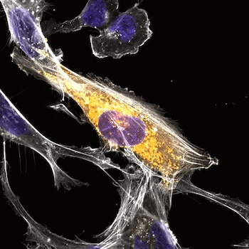Una célula microglial en la que se acumula una microproteína no caracterizada (naranja) alrededor de su núcleo (azul). Un nuevo atlas de microproteínas del Instituto Salk puede ayudar a determinar qué microproteínas se expresan en la microglía y si están implicadas en la salud o la disfunción de estas células cerebrales cruciales
Crédito: Instituto Salk
