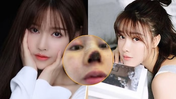 “Mi nariz se volvió negra