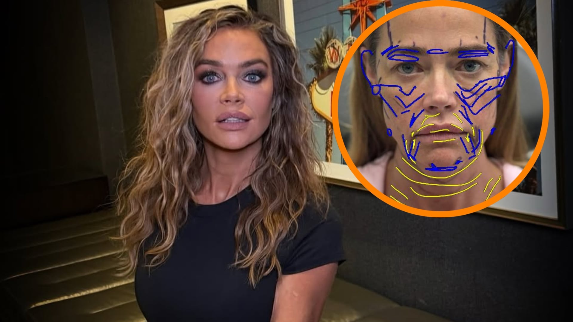 El cirujano de Denise Richards explicó los resultados que la cirugía plástica. (Instagram)