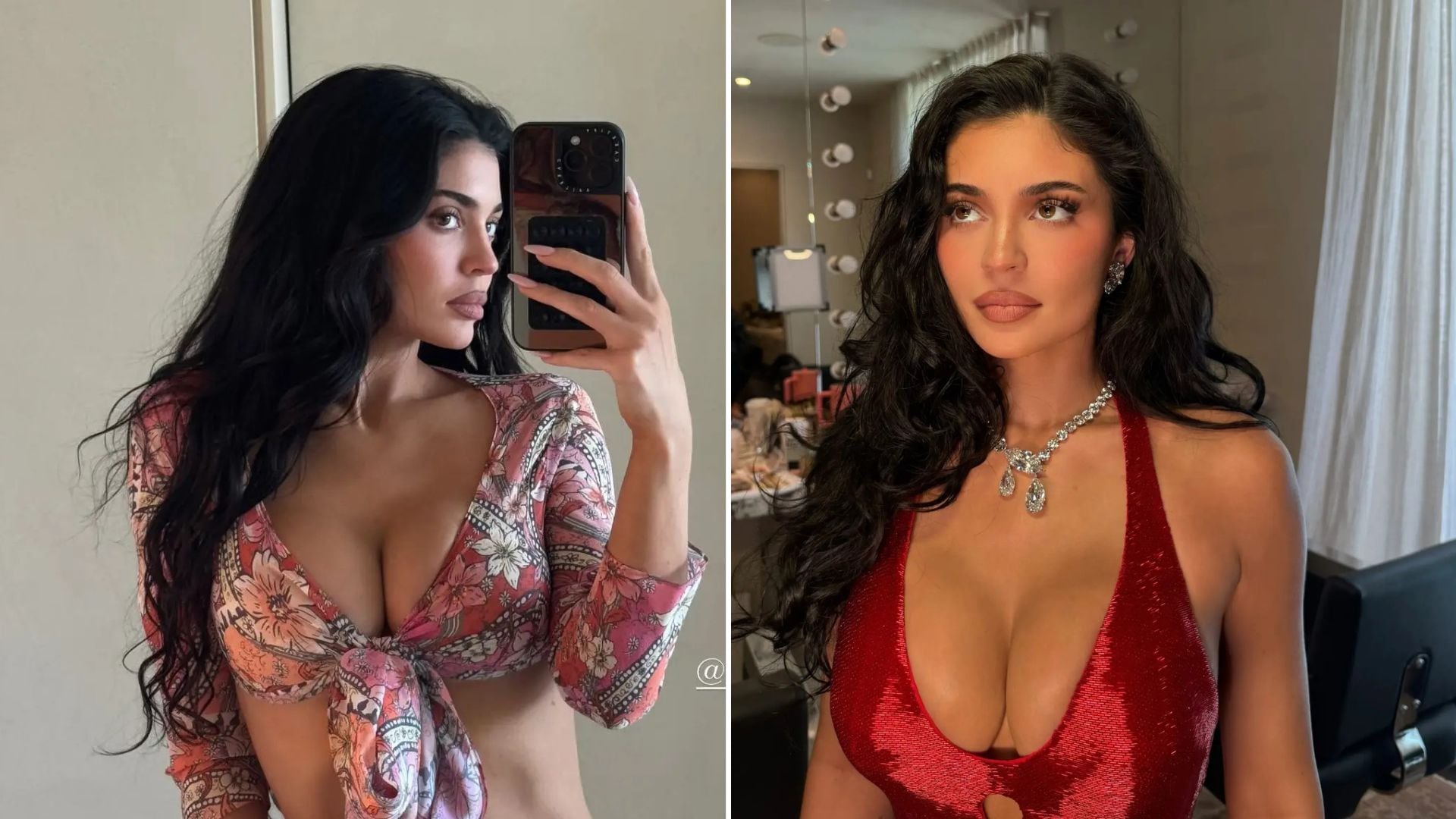 Jenner habló sin filtros sobre sus planes de cirugía estética en el podcast de dos de sus amigas más cercanas. (Instagram)