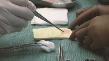 Parches musculares hechos de células