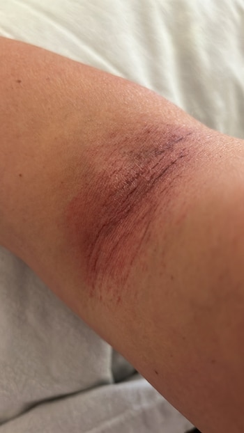 Usuaria denuncia daños en su